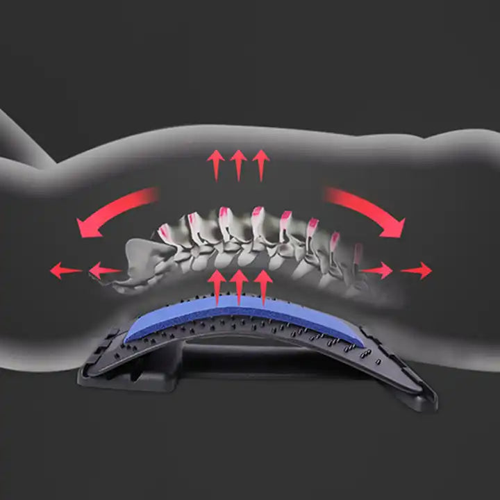 Billede af hvordan en rygstrækker virker på rygsøjlen ved at strække den ud